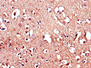 Immunohistochemistry of paraffin-embedded human brain tissue using LRRTM4 Antibody at dilution of 1:100