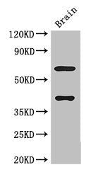 Western Blot  | Positive WB detected in: Mouse brain tissue  | All lanes: LRRTM4 antibody at 3μg/ml  | Secondary  | Goat polyclonal to rabbit IgG at 1/50000 dilution  | Predicted band size: 68, 60 kDa  | Observed band size: 68, 40 kDa