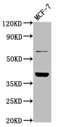 Western Blot | Positive WB detected in: MCF-7 whole cell lysate | All lanes: LAPTM4B antibody at 4.8μg/ml | Secondary | Goat polyclonal to rabbit IgG at 1/50000 dilution | Predicted band size: 42, 26, 36 kDa | Observed band size: 42 kDa