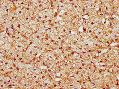 IHC image of CAND1 Antibody diluted at 1:300 and staining in paraffin-embedded human adrenal gland tissue performed on a Leica BondTM system. After dewaxing and hydration, antigen retrieval was mediated by high pressure in a citrate buffer (pH 6.0). Section was blocked with 10% normal goat serum 30min at RT. Then primary antibody (1% BSA) was incubated at 4°C overnight. The primary is detected by a biotinylated secondary antibody and visualized using an HRP conjugated SP system.