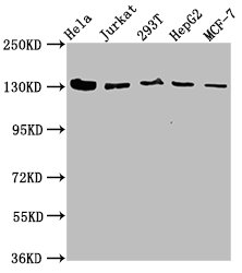 Western Blot  | Positive WB detected in: Hela whole cell lysate, Jurkat whole cell lysate, 293T whole cell lysate, HepG2 whole cell lysate, MCF-7 whole cell lysate  | All lanes: CAND1 antibody at 4.9µg/ml  | Secondary  | Goat polyclonal to rabbit IgG at 1/50000 dilution  | Predicted band size: 137, 118, 46 kDa  | Observed band size: 137 kDa