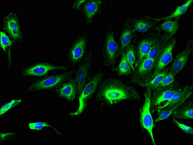 Immunofluorescent analysis of Hela cells using the antibody at dilution of 1:100 and Alexa Fluor 488-congugated AffiniPure Goat Anti-Rabbit IgG(H+L)