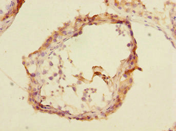 Immunohistochemistry of paraffin-embedded human testis tissue using TRIM69 Antibody at dilution of 1:100Rabbit anti-Human TRIM69 Polyclonal Antibody