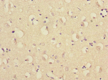 Immunohistochemistry of paraffin-embedded human brain tissue using TRIM69 Antibody at dilution of 1:100Rabbit anti-Human TRIM69 Polyclonal Antibody