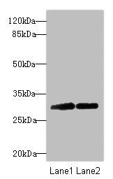 Western blot | All lanes: TRIM69 antibody at 2.24μg/ml | Lane 1: Mouse kidney tissue | Lane 2: Mouse brain tissue | Secondary | Goat polyclonal to rabbit IgG at 1/10000 dilution | Predicted band size: 58, 40, 35, 33 kDa | Observed band size: 58, 32 kDaRabbit anti-Human TRIM69 Polyclonal Antibody