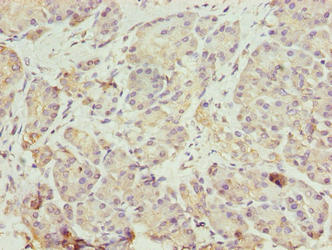 Immunohistochemistry of paraffin-embedded human pancreatic tissue using ERO1B Antibody at dilution of 1:100Rabbit anti-Human ERO1B Polyclonal Antibody