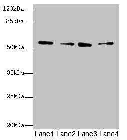 Western blot  | All lanes: ERO1B antibody at 3.2µg/ml  | Lane 1: MCF-7 whole cell lysate  | Lane 2: U251 whole cell lysate  | Lane 3: Mouse liver tissue  | Lane 4: U87 whole cell lysate  | Secondary  | Goat polyclonal to rabbit IgG at 1/10000 dilution  | Predicted band size: 54, 17 kDa  | Observed band size: 54 kDaRabbit anti-Human ERO1B Polyclonal Antibody
