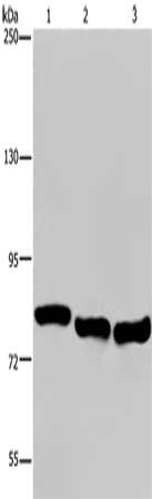 Gel: 6%SDS-PAGE, Lysate: 40 μg, Lane 1-3: A549 cells, Hela cells, K562 cells, Primary antibody: GAB2 Antibody(GAB2 Antibody) at dilution 1/300, Secondary antibody: Goat anti rabbit IgG at 1/8000 dilution, Exposure time: 1 minuteRabbit anti-Human GAB2 Polyclonal Antibody