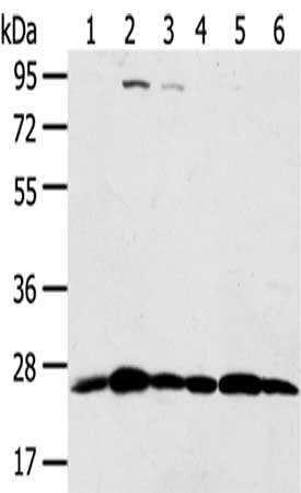 Gel: 8%SDS-PAGE,Lysate: 40 μg,Lane 1-6: Hela cells, Raji cells, Jurkat cells, Human placenta tissue, A431 cells, 231 cells,Primary antibody: PSMB8 Antibody(PSMB8 Antibody) at dilution 1/350 dilution,Secondary antibody: Goat anti rabbit IgG at 1/8000 dilution,Exposure time: 10 secondsRabbit anti-Human PSMB8 Polyclonal Antibody