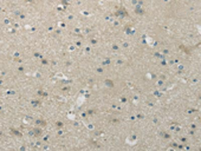 The image is immunohistochemistry of paraffin-embedded human brain tissue using WNK1 Antibody(WNK1 Antibody) at dilution 1/20. (Original magnification: ×200)Rabbit anti-Human WNK1 Polyclonal Antibody