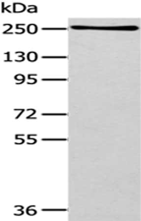 Gel: 6%SDS-PAGE,Lysate: 40 μg,,Primary antibody: WNK1 Antibody(WNK1 Antibody) at dilution 1/200 dilution,Secondary antibody: Goat anti rabbit IgG at 1/8000 dilution,Exposure time: 2 minutesRabbit anti-Human WNK1 Polyclonal Antibody