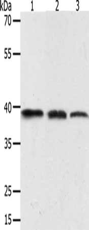 Gel: 10%SDS-PAGE, Lysate: 40 μg, Lane 1-3: PC3 cells, human seminoma tissue, mouse testis tissue, Primary antibody: AMD1 Antibody(AMD1 Antibody) at dilution 1/400, Secondary antibody: Goat anti rabbit IgG at 1/8000 dilution, Exposure time: 40 secondsRabbit anti-Human AMD1 Polyclonal Antibody