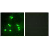 Immunofluorescence analysis of A549 cells, using HAIR antibody.Rabbit anti-Human HR Polyclonal Antibody