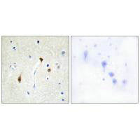 Immunohistochemistry analysis of paraffin-embedded human brain tissue, using HAIR antibody.Rabbit anti-Human HR Polyclonal Antibody