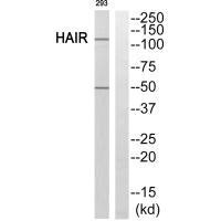 Western blot analysis of extracts from 293 cells, using HAIR antibody.Rabbit anti-Human HR Polyclonal Antibody