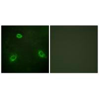 Immunofluorescence analysis of HepG2 cells, using TM16G antibody.Rabbit anti-Human ANO7 Polyclonal Antibody