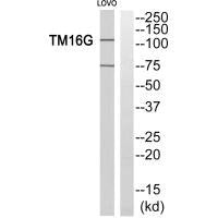 Western blot analysis of extracts from LOVO cells, using TM16G antiobdy.Rabbit anti-Human ANO7 Polyclonal Antibody
