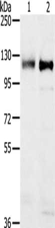 Gel: 6%SDS-PAGE, Lysate: 40 μg, Lane 1-2: 231 cells, K562 cells, Primary antibody: PTPN12 Antibody(PTPN12 Antibody) at dilution 1/200, Secondary antibody: Goat anti rabbit IgG at 1/8000 dilution, Exposure time: 10 minutesRabbit anti-Human PTPN12 Polyclonal Antibody
