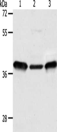 Gel: 10%SDS-PAGE, Lysate: 40 μg, Lane 1-3: Human fetal kidney tissue, 293T cells, human fetal lung tissue, Primary antibody: CNN3 Antibody(CNN3 Antibody) at dilution 1/300, Secondary antibody: Goat anti rabbit IgG at 1/8000 dilution, Exposure time: 1 minuteRabbit anti-Human CNN3 Polyclonal Antibody