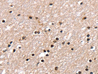 The image on the left is immunohistochemistry of paraffin-embedded Human brain  tissue using RNF40 Antibody(RNF40 Antibody) at dilution 1/25, on the right is treated with fusion protein. (Original magnification: ×200)Rabbit anti-Human RNF40 Polyclonal Antibody