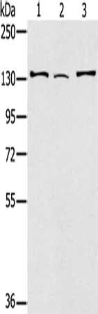 Gel: 6%SDS-PAGE, Lysate: 40 μg, Lane 1-3: Hela cells, 231 cells, A172 cells, Primary antibody: RNF40 Antibody(RNF40 Antibody) at dilution 1/400, Secondary antibody: Goat anti rabbit IgG at 1/8000 dilution, Exposure time: 1 minuteRabbit anti-Human RNF40 Polyclonal Antibody