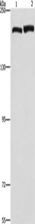 Gel: 6%SDS-PAGE, Lysate: 40 μg, Lane 1-2: A172 cells, hela cells, Primary antibody: CLTC Antibody(CLTC Antibody) at dilution 1/300, Secondary antibody: Goat anti rabbit IgG at 1/8000 dilution, Exposure time: 40 secondsRabbit anti-Human CLTC Polyclonal Antibody