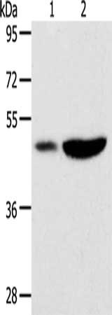 Gel: 10%SDS-PAGE, Lysate: 40 μg, Lane 1-2: Human liver cancer tissue, mouse brain tissue, Primary antibody: PLIN2 Antibody(PLIN2 Antibody) at dilution 1/300, Secondary antibody: Goat anti rabbit IgG at 1/8000 dilution, Exposure time: 40 secondsRabbit anti-Human PLIN2 Polyclonal Antibody