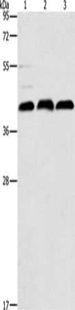 Gel: 12%SDS-PAGE, Lysate: 40 μg, Lane 1-3: K562 cells, mouse kidney tissue, Raji cells, Primary antibody: ATG3 Antibody(ATG3 Antibody) at dilution 1/325, Secondary antibody: Goat anti rabbit IgG at 1/8000 dilution, Exposure time: 10 secondsRabbit anti-Human ATG3 Polyclonal Antibody