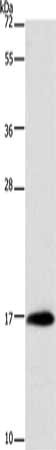 Gel: 10%SDS-PAGE, Lysate: 40 μg, Lane: Mouse stomach tissue, Primary antibody: MYL6 Antibody(MYL6 Antibody) at dilution 1/262.5, Secondary antibody: Goat anti rabbit IgG at 1/8000 dilution, Exposure time: 30 secondsRabbit anti-Human MYL6 Polyclonal Antibody