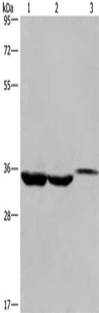 Gel: 10%SDS-PAGE, Lysate: 40 μg, Lane 1-3: Lovo cells, human liver cancer tissue, mouse kidney tissue, Primary antibody: ING2 Antibody(ING2 Antibody) at dilution 1/425, Secondary antibody: Goat anti rabbit IgG at 1/8000 dilution, Exposure time: 40 secondsRabbit anti-Human ING2 Polyclonal Antibody
