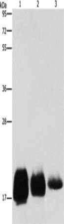 Gel: 10%SDS-PAGE, Lysate: 40 μg, Lane 1-3: Huvec cells, hela cells, SKOV3 cells, Primary antibody: CD59 Antibody(CD59 Antibody) at dilution 1/500, Secondary antibody: Goat anti rabbit IgG at 1/8000 dilution, Exposure time: 30 secondsRabbit anti-Human CD59 Polyclonal Antibody