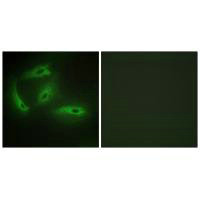 Immunofluorescence analysis of HeLa cells, using CDKL4 antibody.Rabbit anti-Human CDKL4 Polyclonal Antibody