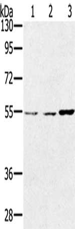 Gel: 8%SDS-PAGE, Lysate: 40 μg, Lane 1-3: Lovo cells, hela cells, SKOV3 cells, Primary antibody: SESN2 Antibody(SESN2 Antibody) at dilution 1/300, Secondary antibody: Goat anti rabbit IgG at 1/8000 dilution, Exposure time: 1 minuteRabbit anti-Human SESN2 Polyclonal Antibody