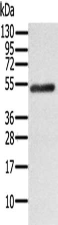 Gel: 6%SDS-PAGE, Lysate: 40 μg, Lane: Human fetal brain tissue, Primary antibody: RORB Antibody(RORB Antibody) at dilution 1/200, Secondary antibody: Goat anti rabbit IgG at 1/8000 dilution, Exposure time: 1 minuteRabbit anti-Human RORB Polyclonal Antibody