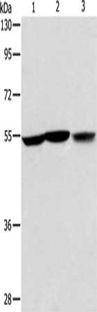 Gel: 8%SDS-PAGE, Lysate: 40 μg, Lane 1-3: Human fetal liver tissue, hela cells, Human fetal kidney tissue, Primary antibody: ALDH9A1 Antibody(ALDH9A1 Antibody) at dilution 1/225, Secondary antibody: Goat anti rabbit IgG at 1/8000 dilution, Exposure time: 30 secondsRabbit anti-Human ALDH9A1 Polyclonal Antibody