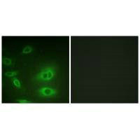 Immunofluorescence analysis of HeLa cells, using ATP1α1/Na+K+ ATPase1 (Ab-23) antibody.Rabbit anti-Rattus norvegicus (Rat) Atp1a1 Polyclonal Antibody