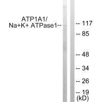Western blot analysis of extracts from HeLa cells, using ATP1α1/Na+K+ ATPase1 (Ab-23) antibody.Rabbit anti-Rattus norvegicus (Rat) Atp1a1 Polyclonal Antibody