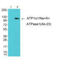 Western blot analysis of extracts from K562 cells (Lane 2), using ATP1α1/Na+K+ ATPase1 (Ab-23) antiobdy. The lane on the left is treated with synthesized peptide.Rabbit anti-Rattus norvegicus (Rat) Atp1a1 Polyclonal Antibody