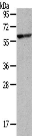 Gel: 6%SDS-PAGE,Lysate: 40 μg,,Primary antibody: IVL Antibody(IVL Antibody) at dilution 1/200 dilution,Secondary antibody: Goat anti rabbit IgG at 1/8000 dilution,Exposure time: 30 seconds