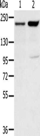 Gel: 6%SDS-PAGE, Lysate: 40 μg, Lane 1-2: 231 cells, hela cells, Primary antibody: KDM5A Antibody(KDM5A Antibody) at dilution 1/200, Secondary antibody: Goat anti rabbit IgG at 1/8000 dilution, Exposure time: 2 minutes