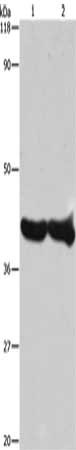 Gel: 8%SDS-PAGE, Lysate: 20 μg, Lane 1-2: 293T cells, Hela cells, Primary antibody: GAPDH Antibody(GAPDH Antibody) at dilution 1/1000, Secondary antibody: Goat anti rabbit IgG at 1/8000 dilution, Exposure time: 15 secondsRabbit anti-Human GAPDH Polyclonal Antibody