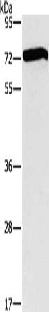 Gel: 8%SDS-PAGE, Lysate: 40 μg, Lane: 293T cells, Primary antibody: SMAD4 Antibody(SMAD4 Antibody) at dilution 1/300, Secondary antibody: Goat anti rabbit IgG at 1/8000 dilution, Exposure time: 2 minutesRabbit anti-Human SMAD4 Polyclonal Antibody