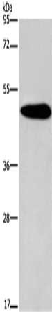 Gel: 8%SDS-PAGE, Lysate: 40 μg, Lane: Mouse brain tissue, Primary antibody: KCNG2 Antibody(KCNG2 Antibody) at dilution 1/650, Secondary antibody: Goat anti rabbit IgG at 1/8000 dilution, Exposure time: 3 minutes