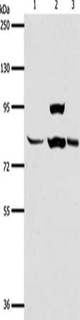Gel: 8%SDS-PAGE, Lysate: 40 μg, Lane 1-3: Human liver cancer tissue, hela cells, mouse lung tissue, Primary antibody: AGAP1 Antibody(AGAP1 Antibody) at dilution 1/400, Secondary antibody: Goat anti rabbit IgG at 1/8000 dilution, Exposure time: 1 minute