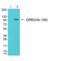 Western blot analysis of extracts from 293 cells (Lane 2), using Gab2 (Ab-159) antiobdy. The lane on the left is treated with synthesized peptide.Rabbit anti-Human GAB2 Polyclonal Antibody