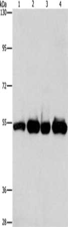 Gel: 8%SDS-PAGE, Lysate: 40 μg, Lane 1-4: Human bladder carcinoma tissue, A172 cells, human fetal brain tissue, hela cells, Primary antibody: PDE4D Antibody(PDE4D Antibody) at dilution 1/500, Secondary antibody: Goat anti rabbit IgG at 1/8000 dilution, Exposure time: 10 secondsRabbit anti-Human PDE4D Polyclonal Antibody