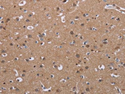 The image on the left is immunohistochemistry of paraffin-embedded Human brain  tissue using LUM Antibody(LUM Antibody) at dilution 1/40, on the right is treated with fusion protein. (Original magnification: ×200)