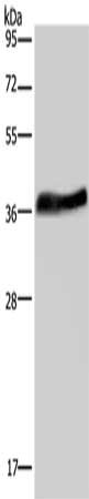 Gel: 10%SDS-PAGE, Lysate: 40 μg, Lane: Jurkat cells, Primary antibody: LUM Antibody(LUM Antibody) at dilution 1/200, Secondary antibody: Goat anti rabbit IgG at 1/8000 dilution, Exposure time: 20 seconds