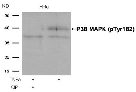 Western blot analysis of extracts from Hela cells, treated with TNFa or calf intestinal phosphatase (CIP), using P38 MAPK (Phospho-Tyr182) Antibody.