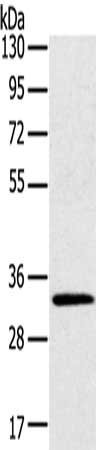Gel: 8%SDS-PAGE, Lysate: 40 μg, Lane: Mouse brain tissue, Primary antibody: STK16 Antibody(STK16 Antibody) at dilution 1/400, Secondary antibody: Goat anti rabbit IgG at 1/8000 dilution, Exposure time: 5 secondsRabbit anti-Human STK16 Polyclonal Antibody